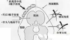 發(fā)酵料